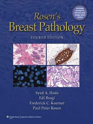 Rosen's Breast Pathology. Syed A. Hoda, MD, Brogi.